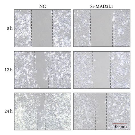 Inhibition of MAD2L1 Mediates Pulmonary Fibrosis through Impairment of ... 