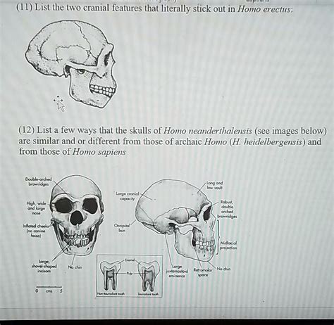 Homo Neanderthalensis Skull Features