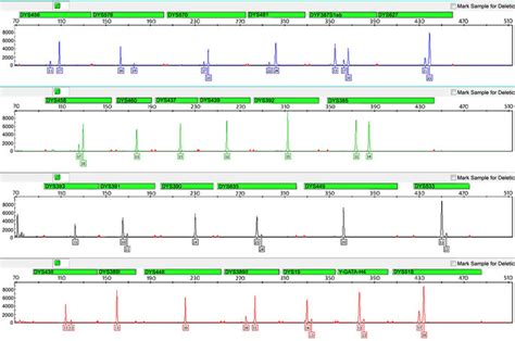 Electropherogram Of A Malemale Dna Mixture Sample 9948007 At Ratio Download Scientific