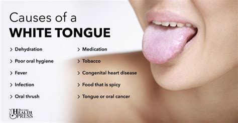 White Tongue 10 Causes And Natural Remedies Congenital Heart Disease Natural Remedies Oral