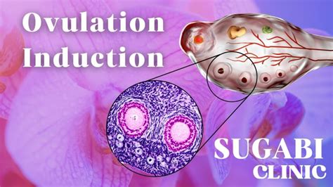 Ovulation Induction Boosting Fertility With Art Sugabi Clinic