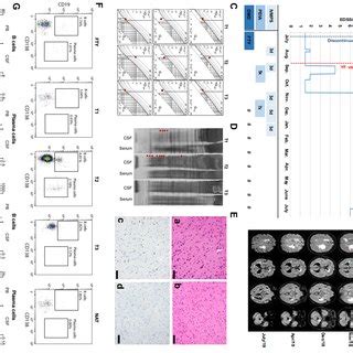 Time Course Of Clinical Relapse Manifestation Diagnostics And