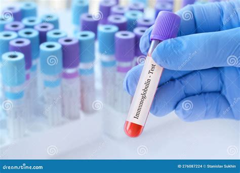 Doctor Holding A Test Blood Sample Tube With Immunoglobulin Test On The