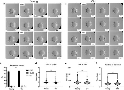 Morphokinetic Parameters Of Mouse Oocyte Meiotic Maturation And Cumulus