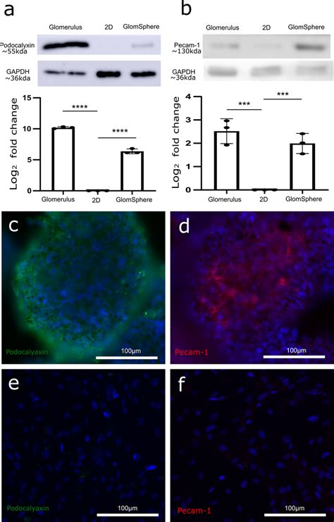 Comparative Expression Of Podocalyxin And Pecam In Glomspheres D