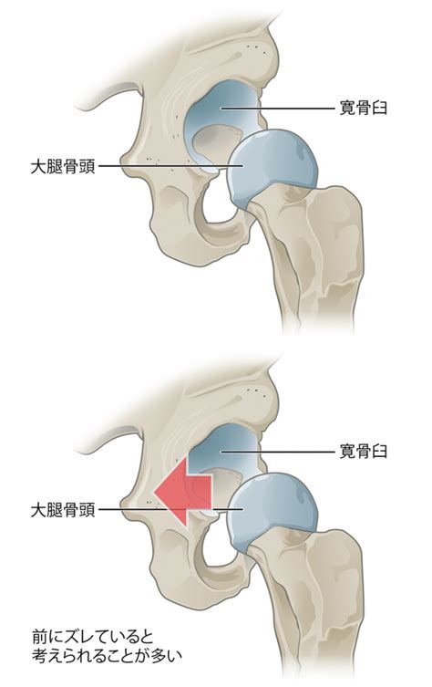 股関節のつまり・セルフで改善するストレッチやトレーニングの全方法