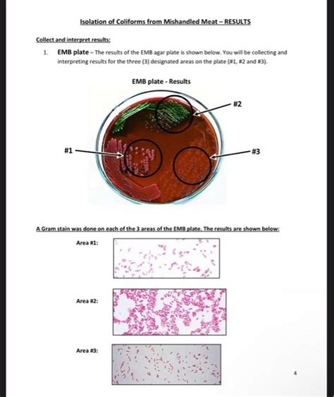 Solved Collect and interpret results: 1. EMB plate - The | Chegg.com