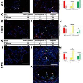 Identification Of Il R And Cd Cells In Situ A B Immunolabeling