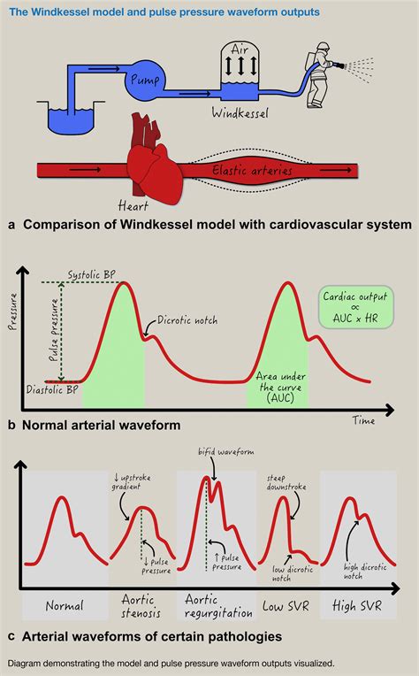 Cardiac Output Monitoring Anaesthesia And Intensive Care Medicine