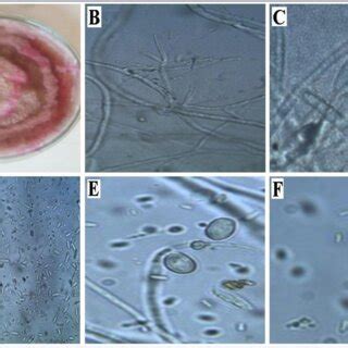 Showing A Pda Colony Of F Thapsinum B Mycelium Of F Thapsinum C