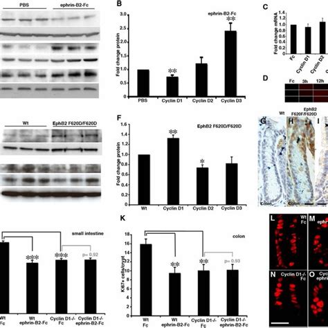 Dissociation Of Ephb Signaling Pathways During Tumor Progression