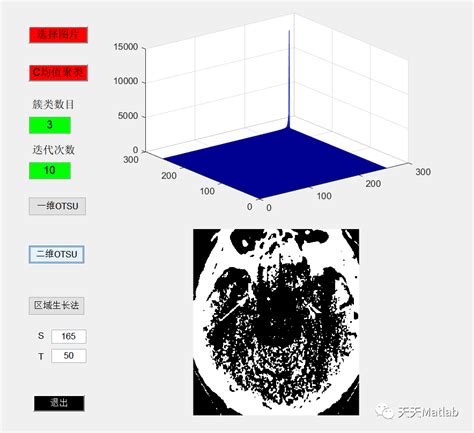 【图像分割】基于oust、均值聚类和区域生长法实现医学图像处理系统附gui界面智能医学图像分割 Matlab Gui用户系统界面怎么设计
