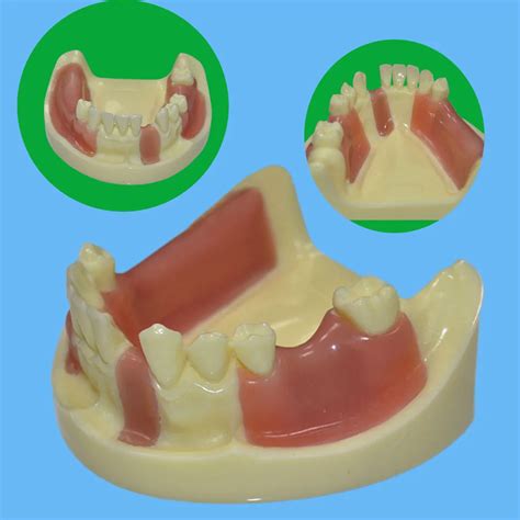 Dental Lower Jaw Implant Teeth Model With Drilling Silicone Soft Gum