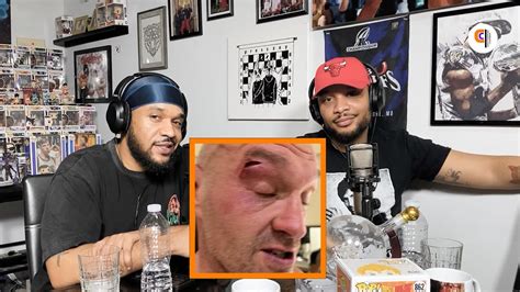 Tyson Fury FAKES Accidental Cut Above Eye During Sparring To AVOID