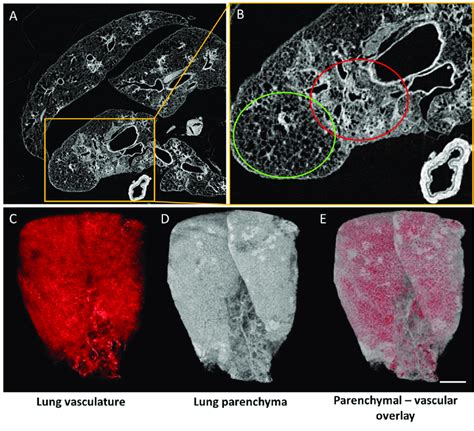 High resolution ex vivo μCT of isolated rodent lung A Reconstructed