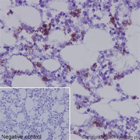 Neutrophil Elastase Epr Ab Abcam