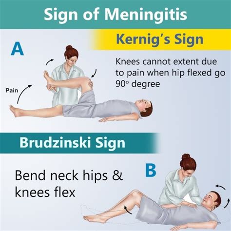 Neurological System NCLEX Review Medcrine