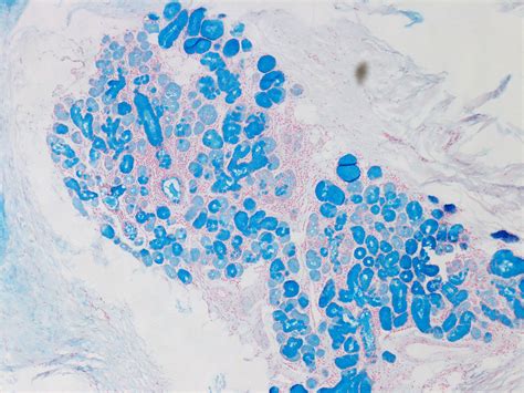 Alcian Blue Staining Of 31 Year Old Human Donor 10