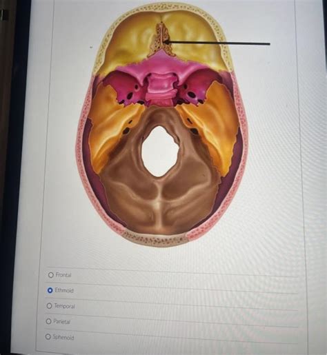 Solved Maxilla Temporal Sphingid Vomer Ethmoid Sphenoid