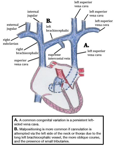 Jugular Vein Anatomy