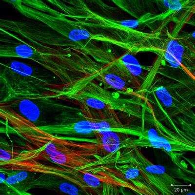 Vimentin Antibody (NBP1-31327): Novus Biologicals