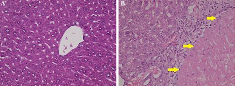 Histopathological Changes In The Liver Tissue Stained With H E Figure