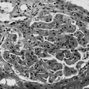 Chorionic Plate Histology