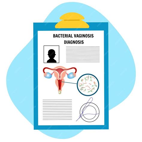 Premium Vector Blank Of Bacterial Vaginosis Diagnosis Thrush In Vector Illustration