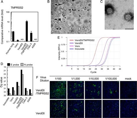 Enhanced Isolation Of SARS CoV 2 By TMPRSS2 Expressing Cells PNAS