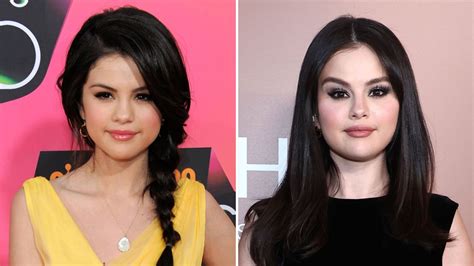 Did Selena Gomez Get Plastic Surgery? Inside Rumors | Life & Style