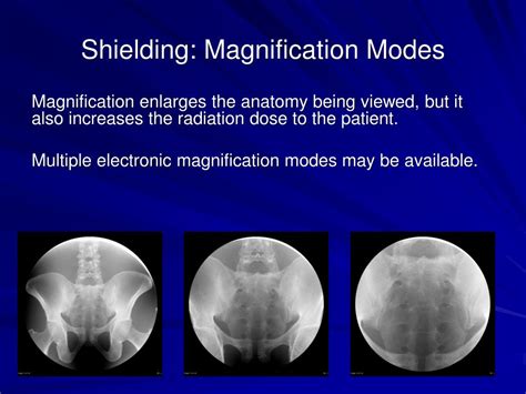 Ppt Fluoroscopy Safety Powerpoint Presentation Free Download Id368172