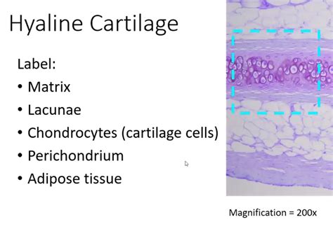 SOLVED: Hyaline Cartilage Label: Matrix Lacunae Chondrocytes (cartilage cells) Perichondrium ...