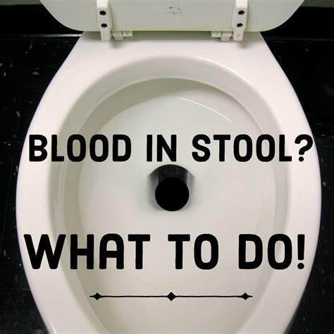 Noticed Blood in Stool? Here’s What to Do... | HubPages