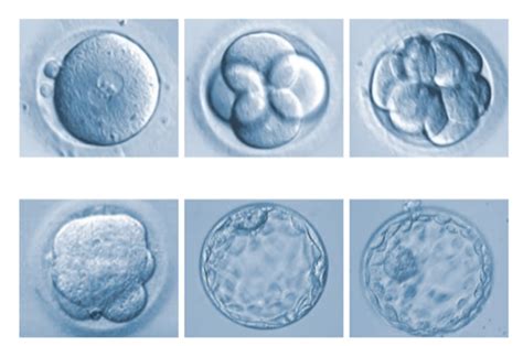 试管婴儿囊胚一共分几级？哪个等级更好？ 知乎