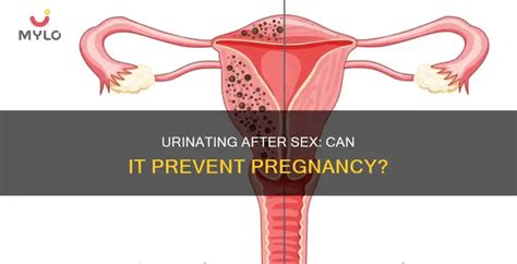 Urinating After Sex Can It Prevent Pregnancy MedShun