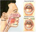 Mandelentz Ndung Tonsillitis Symptome Verlauf Und Behandlung