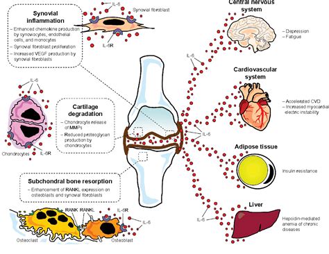 Autoimmune Disease That Affects Joints Autoimmune Disorders Affecting