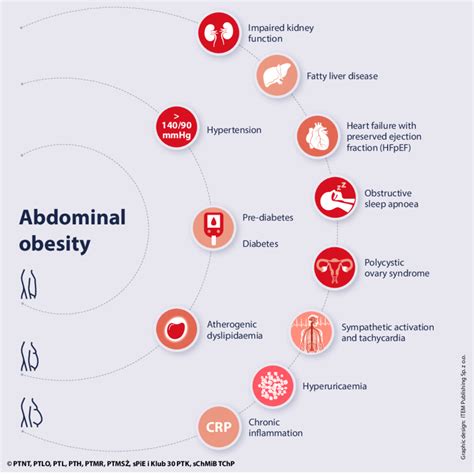 Main And Additional Conditions Of The Metabolic Syndrome As The