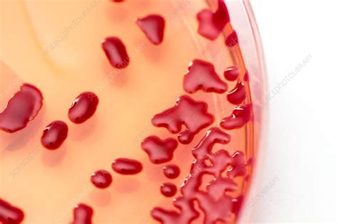 Serratia marcescens culture - Stock Image - C036/9186 - Science Photo ...