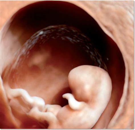 Echographie 3D HD Live un foetus à 8 semaines d aménorrhée