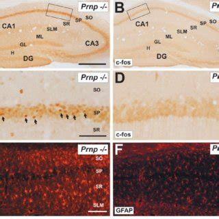 A-D: Fluorescence images of organotypic hippocampal slice cultures from ... 