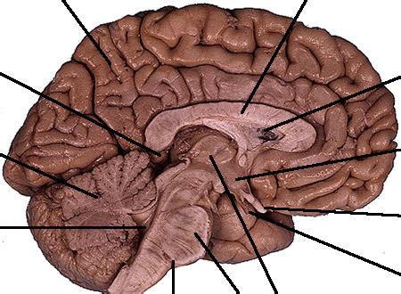 Lateral Ventricle Corpus Callosum