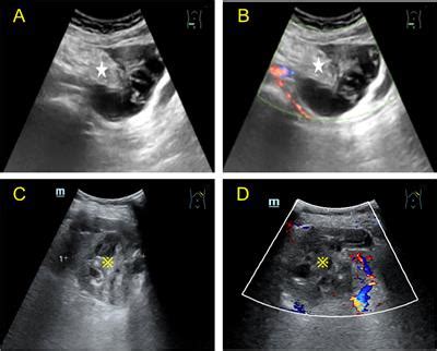 Frontiers Contrast Enhanced Ultrasonography Findings Of Lamns With