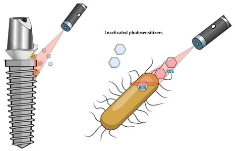 Photodynamic Therapy for Peri-Implant Diseases