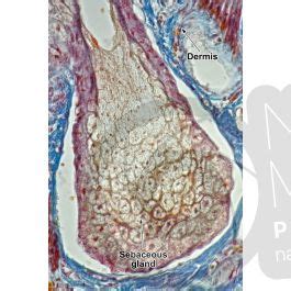 Man Sebaceous Gland Vertical Section 250X Sebaceous Gland