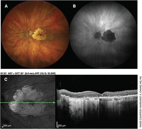 Ophthalmology Management Pentavision