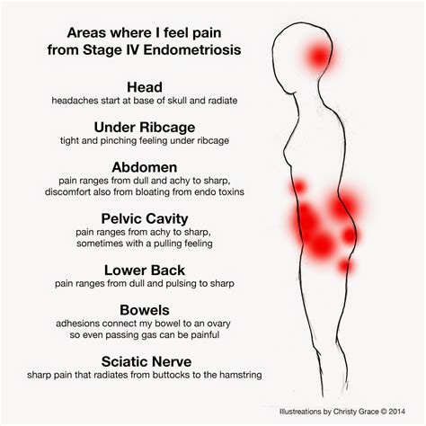 Chest Pain During Fertile Period at Martha Chouinard blog