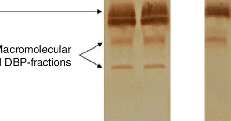 Western Blot Analysis Of Vitamin D Binding Protein DBP In Trauma