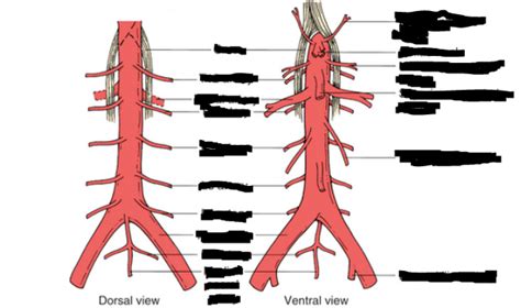 GU Anatomy Lecture 2 Aorta and IVC Diagram | Quizlet