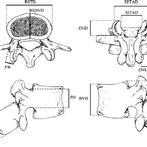 Pdf Sex Determination By Discriminant Function Analysis Of Lumbar